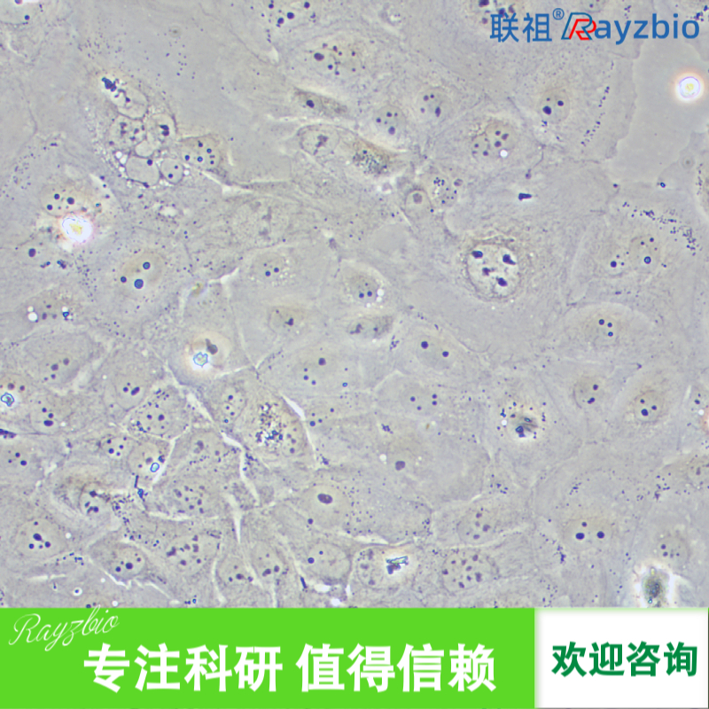 人牙髓干细胞