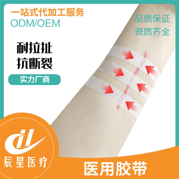 医用胶带 免缝胶带 一站式采购 规格齐全 售后保障 采购无忧